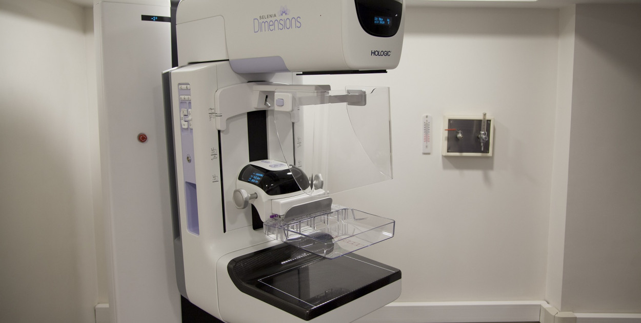 Bezpłatna mammografia dla kobiet wieku 45 – 74 [harmonogram]