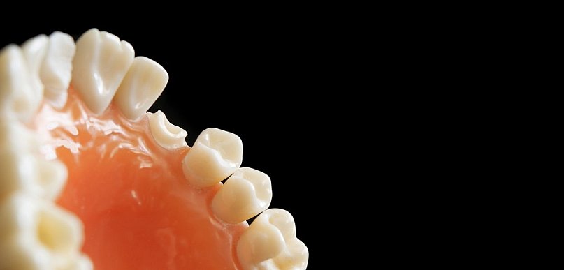 Odbudowa zębów jako element kompleksowego leczenia stomatologicznego