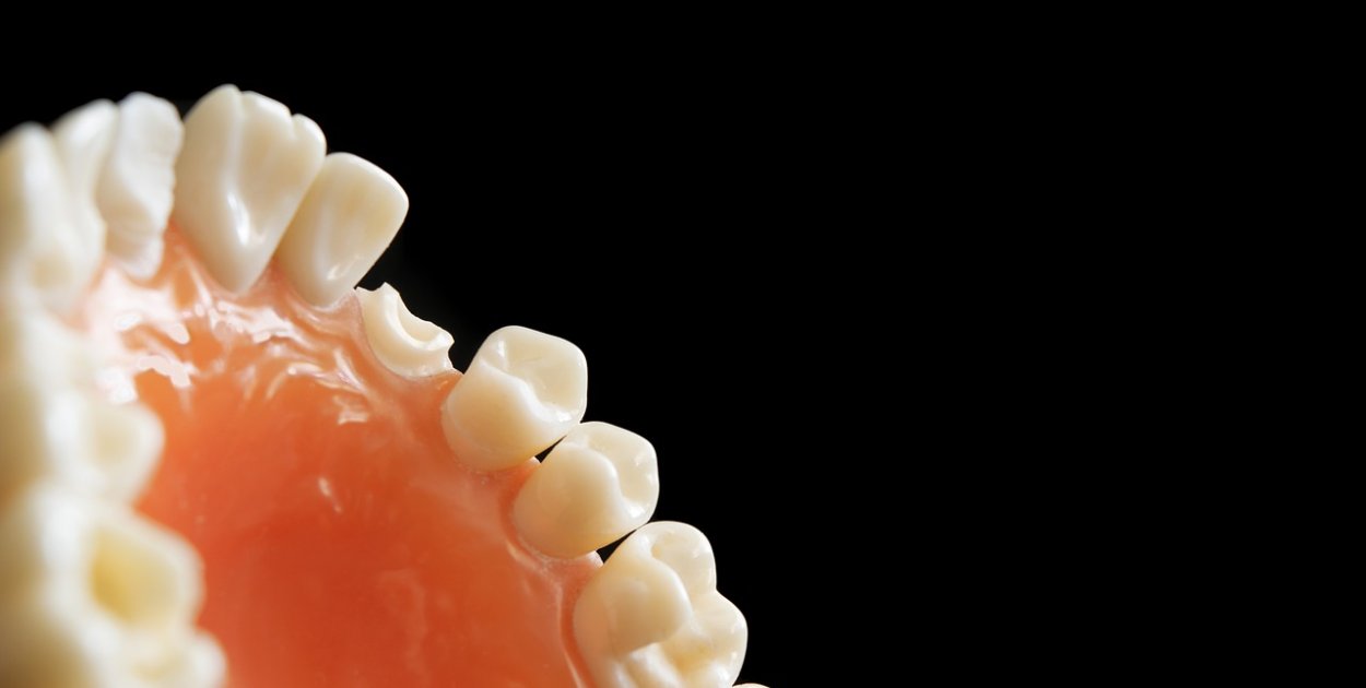 Odbudowa zębów jako element kompleksowego leczenia stomatologicznego